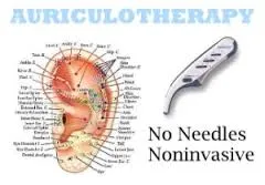 auriculotherapy auriculotherapy